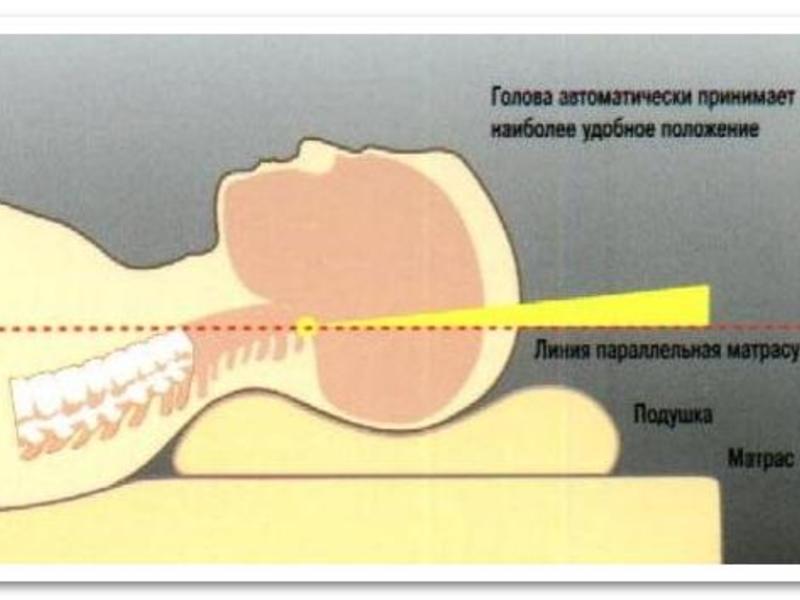 Положение затылка. Расположение головы на ортопедической подушке. Правильная подушка для сна при шейном остеохондрозе. Положение головы на ортопедической подушке. Правильное положение головы на подушке.