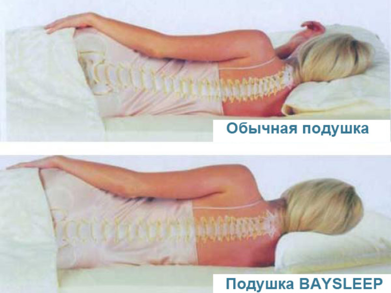 Применение ортопедической подушки
