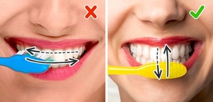 Советы по чистке зубов