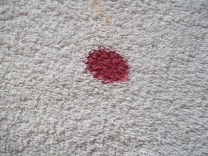 Как очистить кровь с дивана